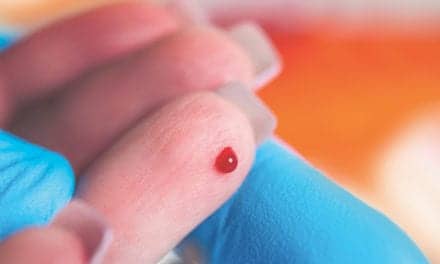 Finger Prick Tests Exemplify Advancements in Alzheimer’s Screening 