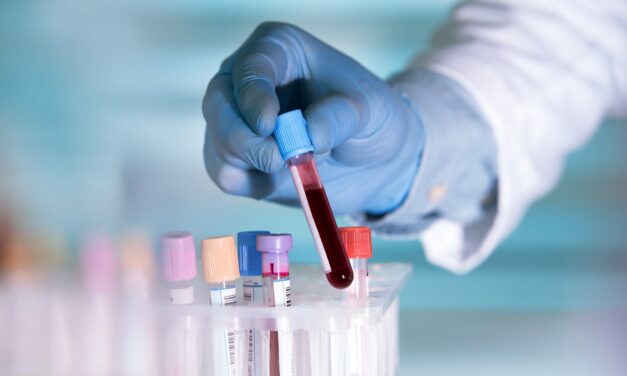 Mayo Clinic Labs and Progentec Collaborate on Advanced Biomarker Tests for Autoimmune Diseases