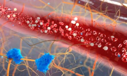 Blood Test May Be Future of Pancreatic Cancer Detection