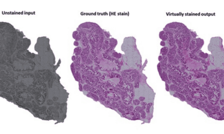 Chemical Staining Replaced by AI-based Method