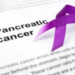 Artificial Intelligence Predicts Future Pancreatic Cancer
