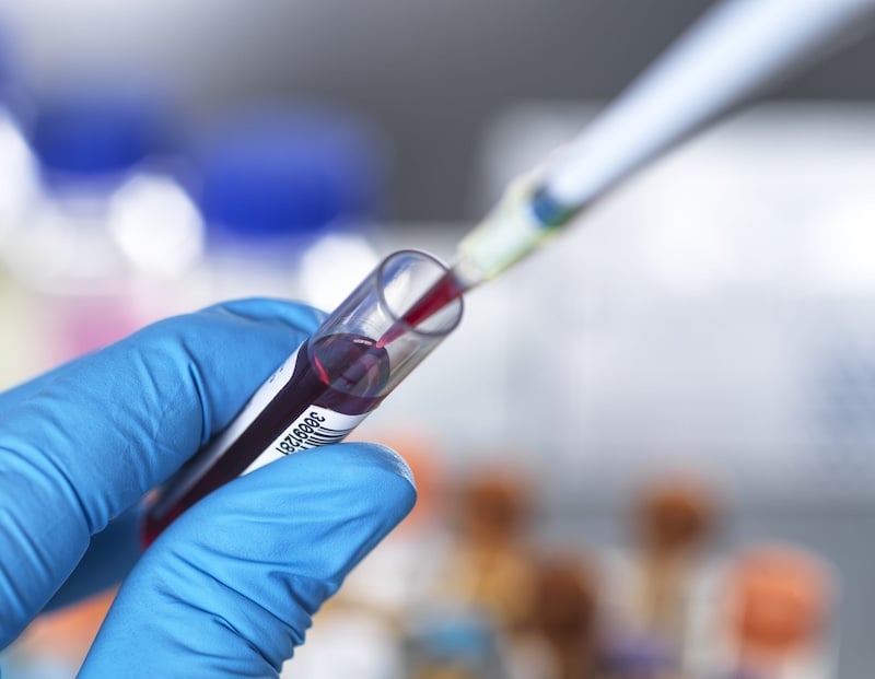 Labcorp Plasma Detect and PGDx Elio Plasma Focus Dx Launched